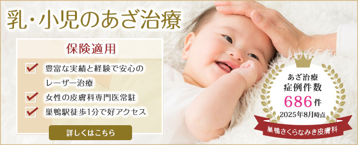 乳・小児のあざ治療